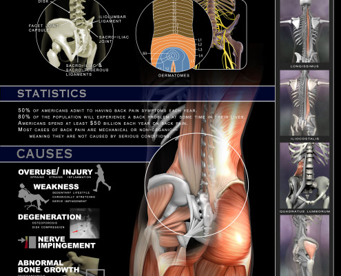 Back pain poster
