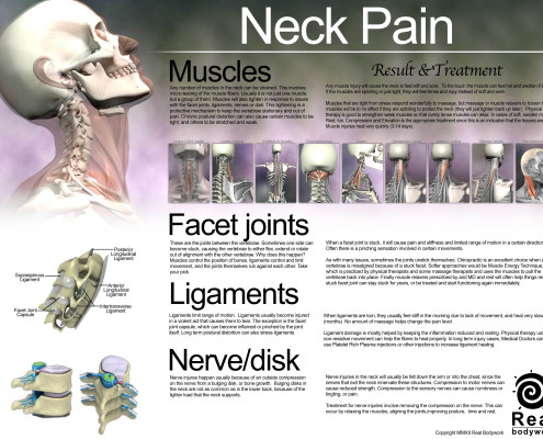 Neck pain infographic