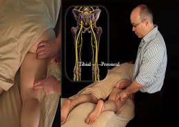 Nerve mobilization for the tibial-nerve