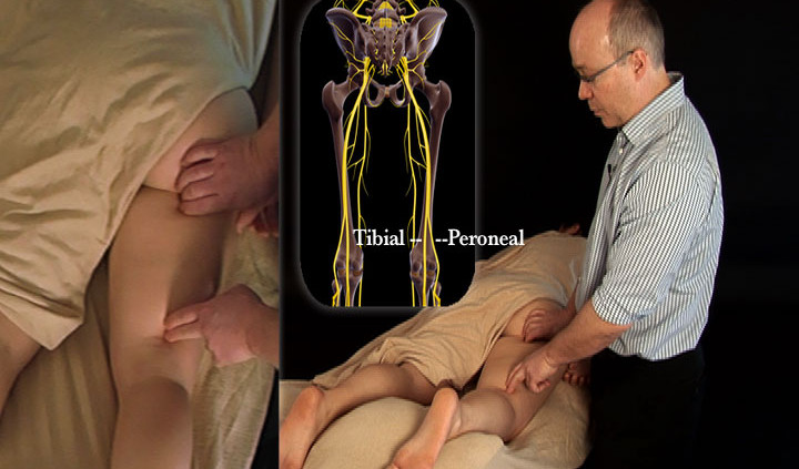Nerve mobilization for the tibial-nerve