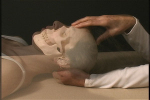 Frontal bone Cranial release