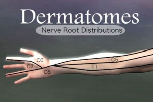 dermatomes in the arm