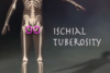 ischial tuberosity