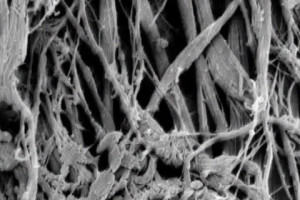 Connective Tissue Cross linkages microscopic view