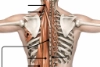 Muscles of the deep back group.